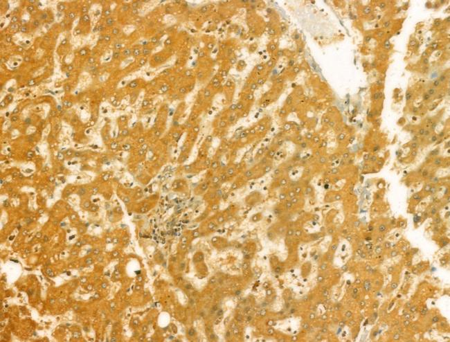 RAB3GAP2 Antibody in Immunohistochemistry (Paraffin) (IHC (P))