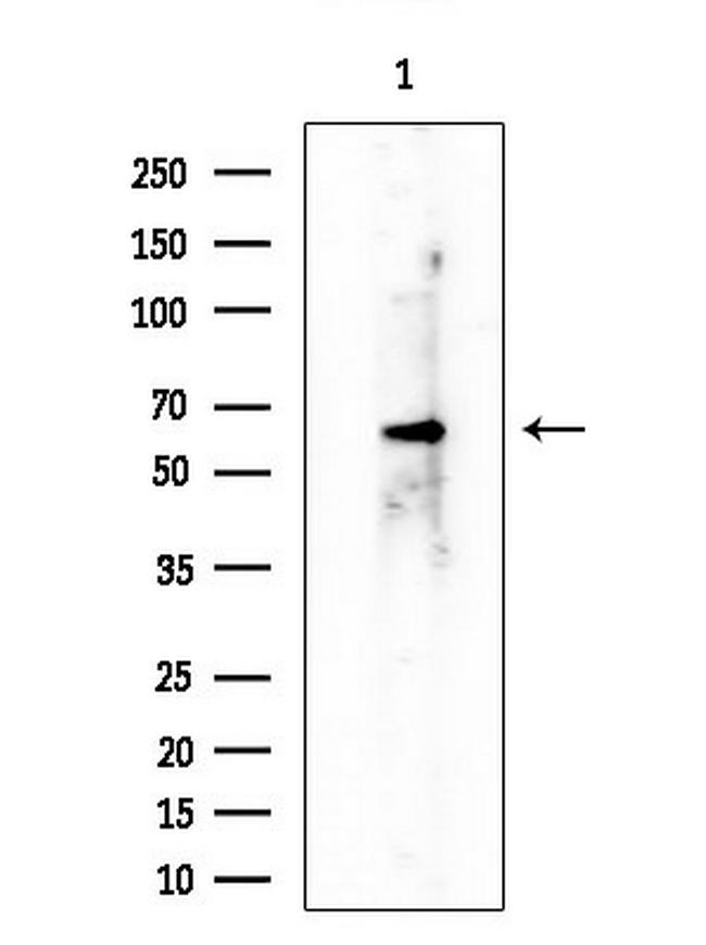 RAPGEF5 Antibody in Western Blot (WB)