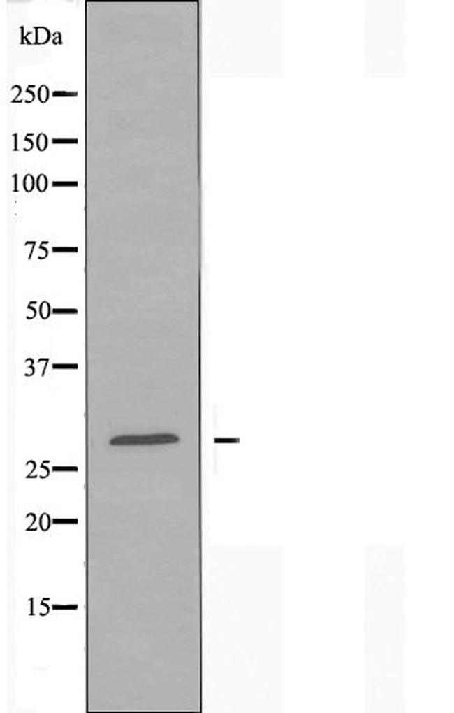 RAB18 Antibody in Western Blot (WB)