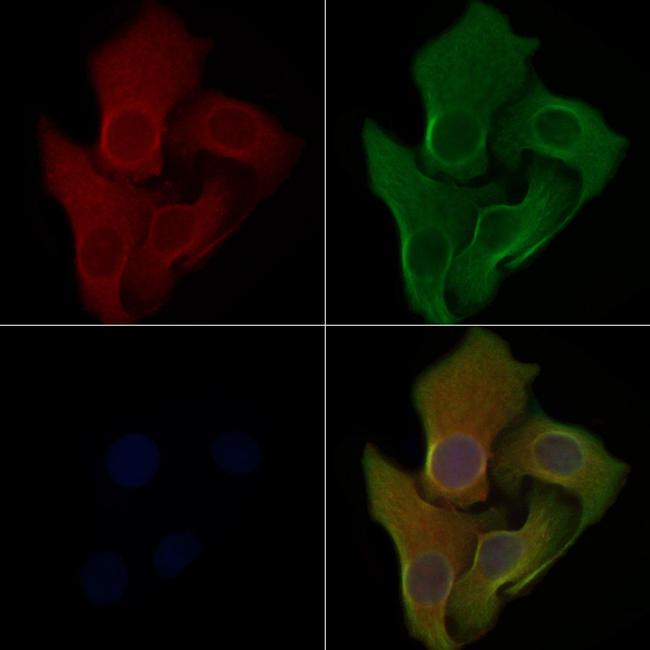 RAB2A Antibody in Immunocytochemistry (ICC/IF)