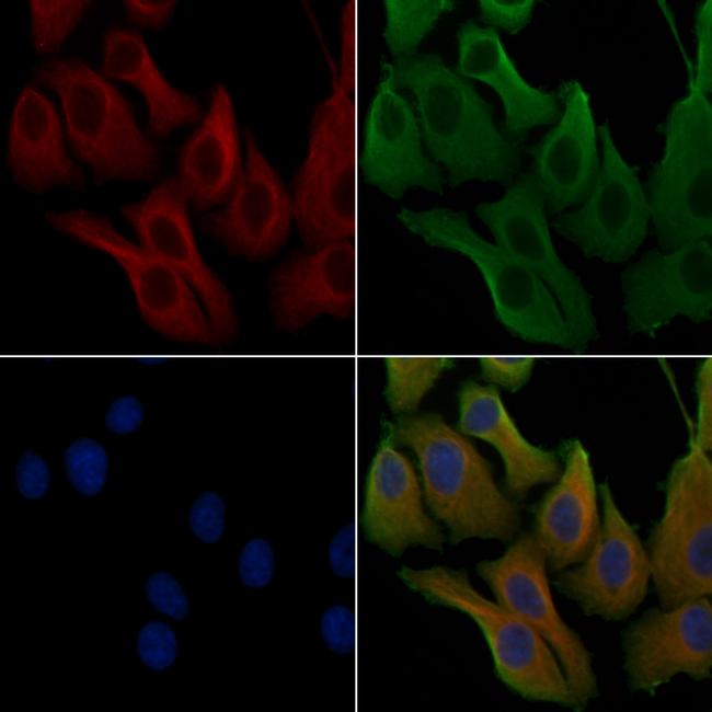 RAB5C Antibody in Immunocytochemistry (ICC/IF)