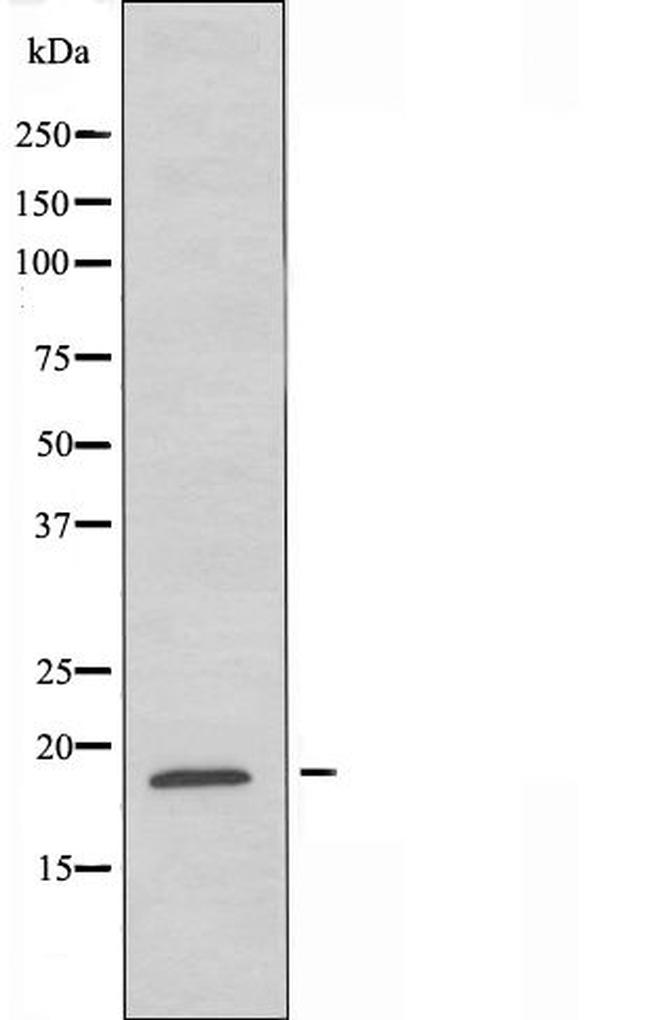 RAP2B Antibody in Western Blot (WB)