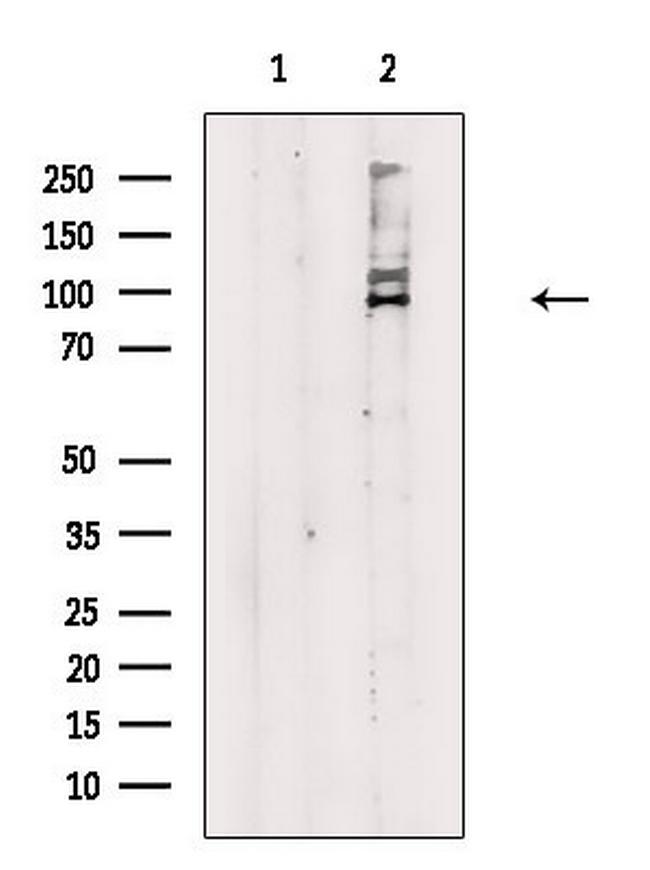 SRPK1 Antibody in Western Blot (WB)