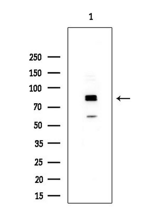 TLK2 Antibody in Western Blot (WB)