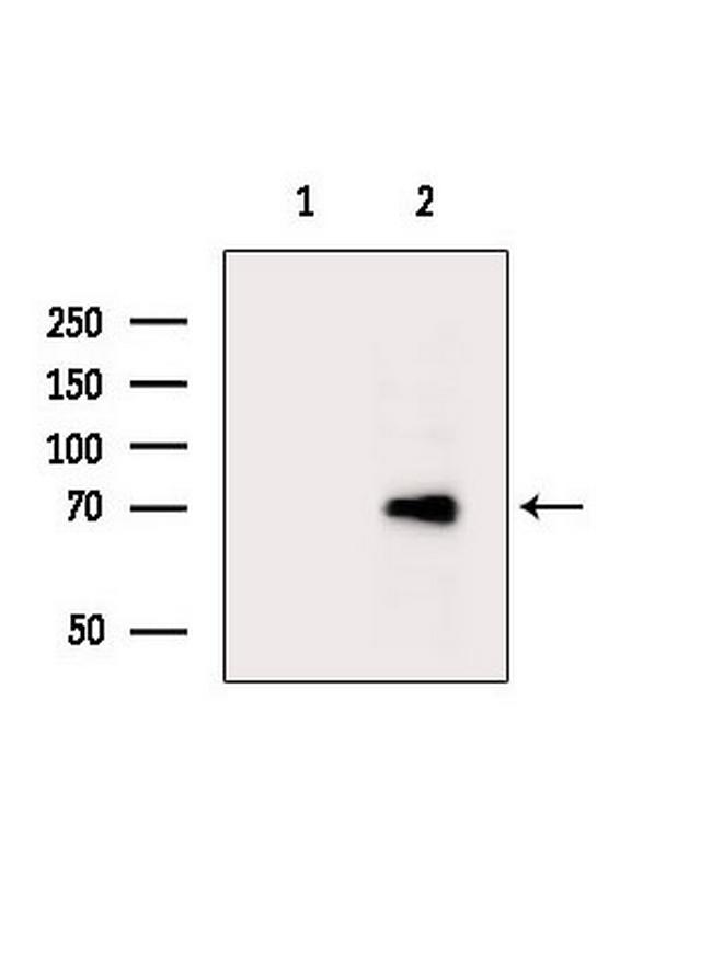 PPP2R5D Antibody in Western Blot (WB)