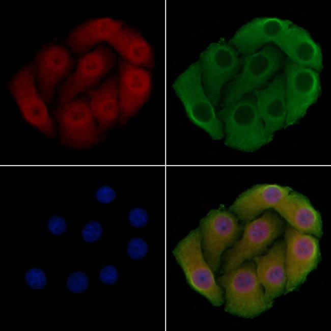 PPP2R1B Antibody in Immunocytochemistry (ICC/IF)