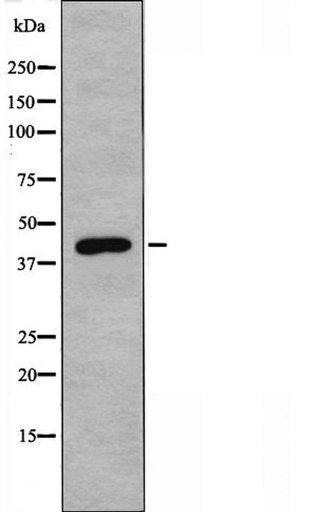 SERPINB4 Antibody in Western Blot (WB)