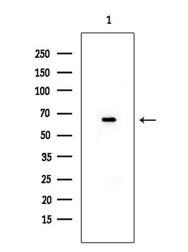 SESN1 Antibody in Western Blot (WB)