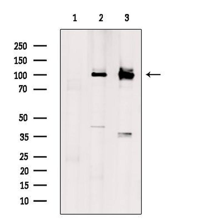 SLC9A6 Antibody in Western Blot (WB)