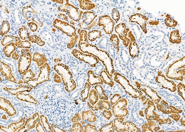 SLC5A6 Antibody in Immunohistochemistry (Paraffin) (IHC (P))