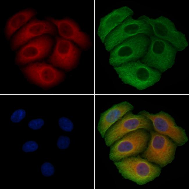 SNX3 Antibody in Immunocytochemistry (ICC/IF)