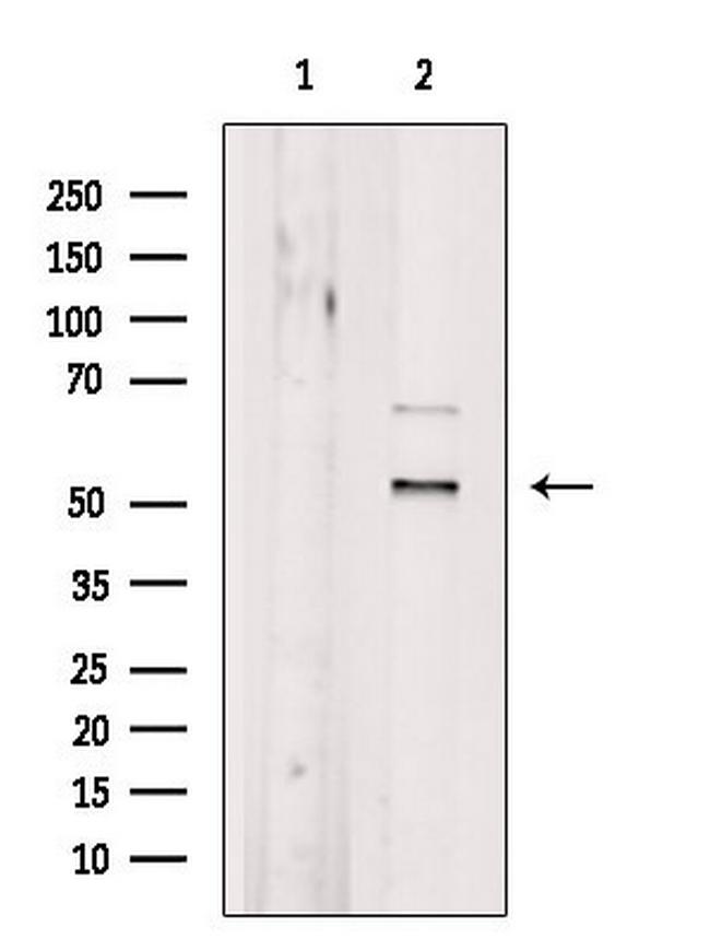 SF3B4 Antibody in Western Blot (WB)