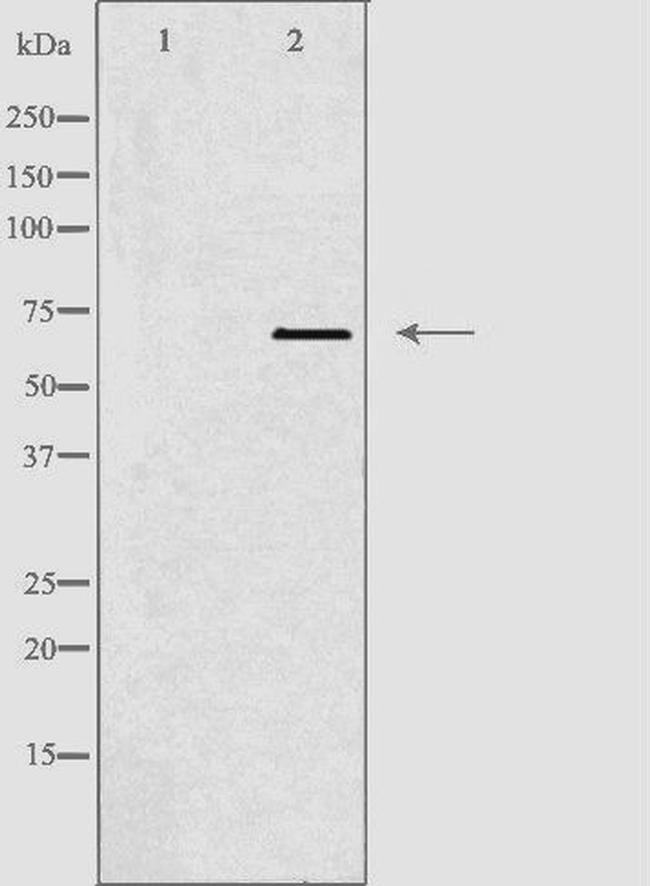 TBX18 Antibody in Western Blot (WB)