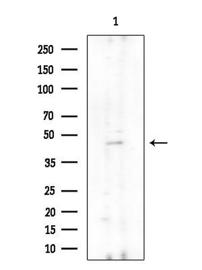 UEVLD Antibody in Western Blot (WB)