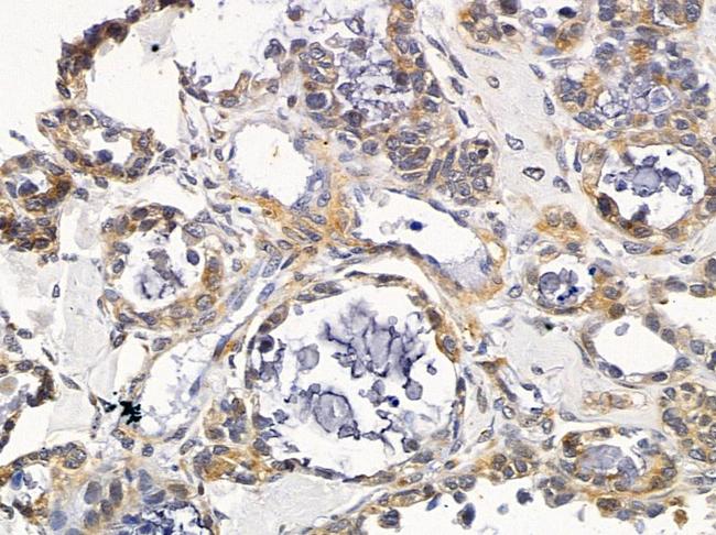 VTI1A Antibody in Immunohistochemistry (Paraffin) (IHC (P))