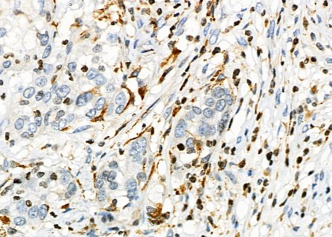 PTGR2 Antibody in Immunohistochemistry (Paraffin) (IHC (P))