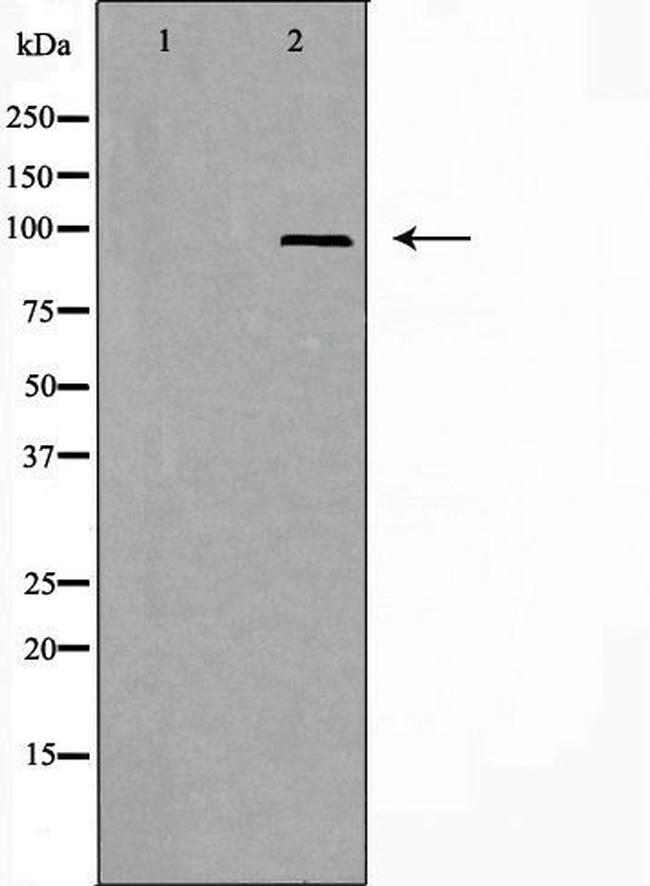 A20A1 Antibody in Western Blot (WB)