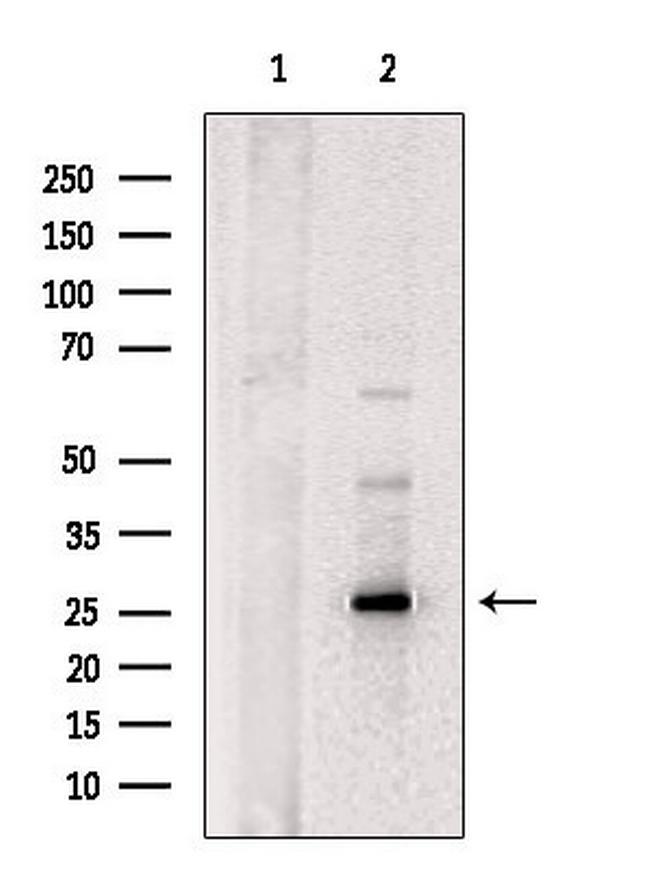 FGF13 Antibody in Western Blot (WB)