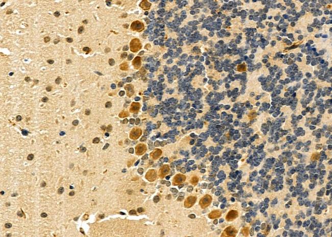 IL11RA Antibody in Immunohistochemistry (Paraffin) (IHC (P))