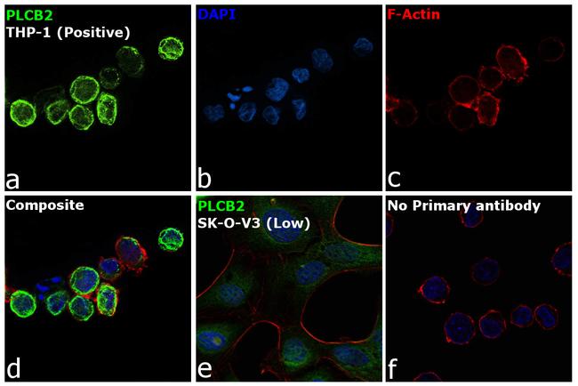 PLCB2 Antibody in Immunocytochemistry (ICC/IF)