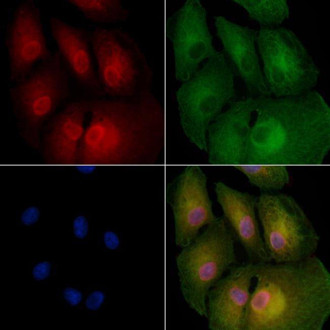 BCL7A Antibody in Immunocytochemistry (ICC/IF)