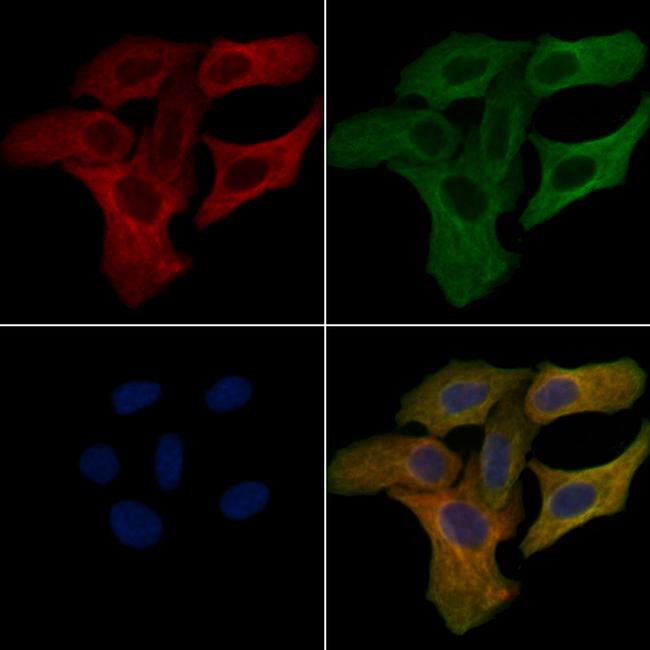 CYP4F11 Antibody in Immunocytochemistry (ICC/IF)