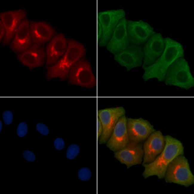 ERI1 Antibody in Immunocytochemistry (ICC/IF)