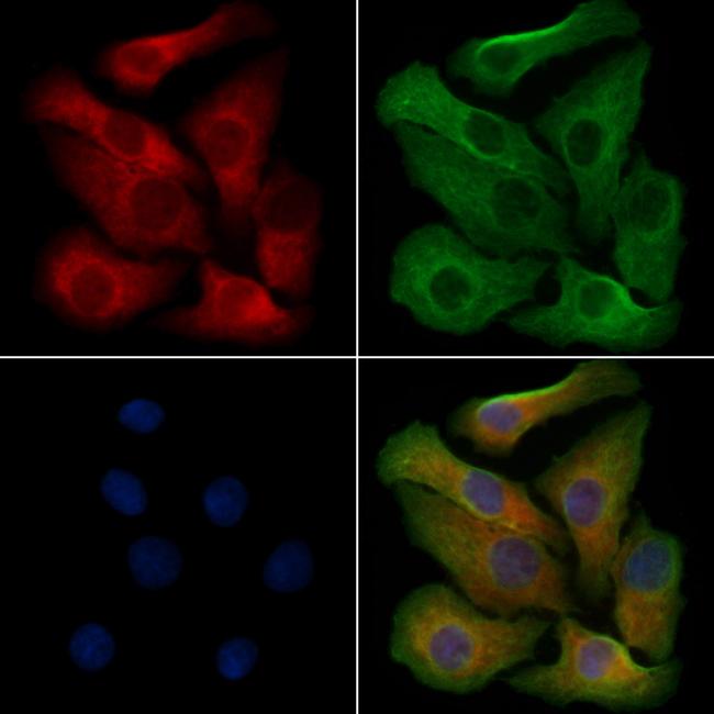 NKG2D Antibody in Immunocytochemistry (ICC/IF)