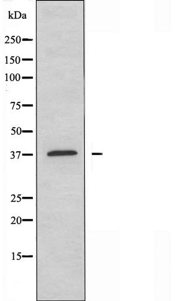 RXFP4 Antibody in Western Blot (WB)