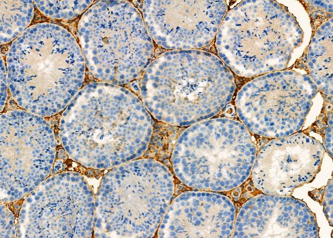 GPR132 Antibody in Immunohistochemistry (Paraffin) (IHC (P))