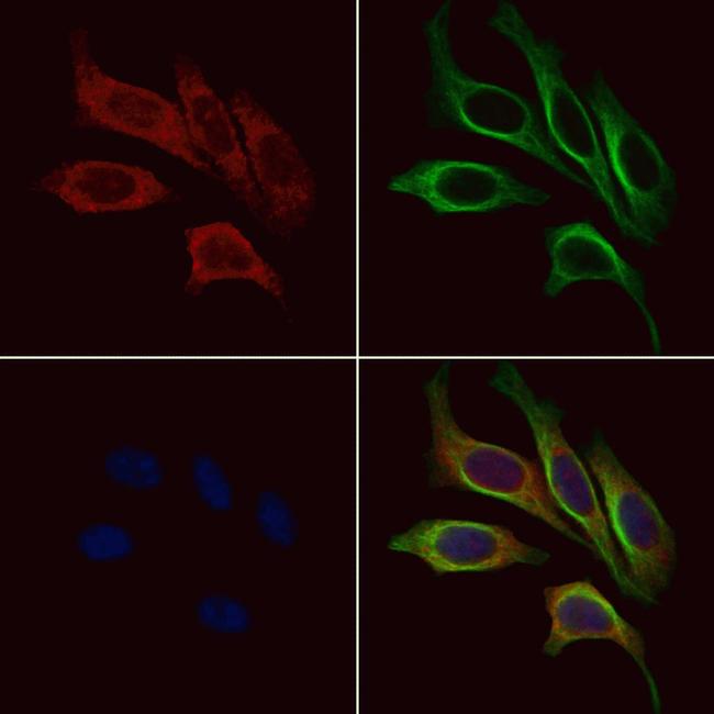 MC2R Antibody in Immunocytochemistry (ICC/IF)