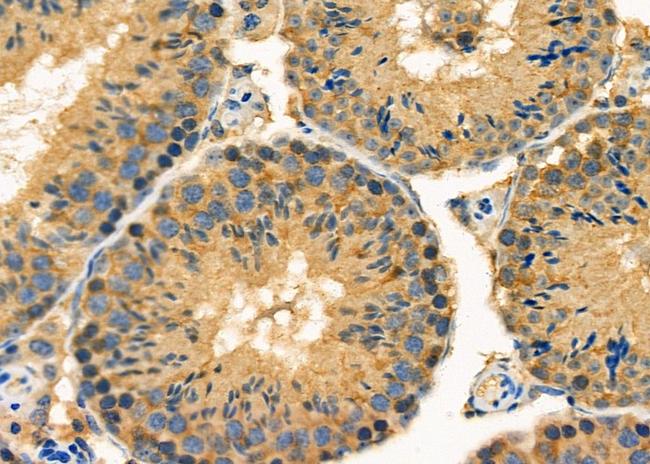 EDG4 Antibody in Immunohistochemistry (Paraffin) (IHC (P))