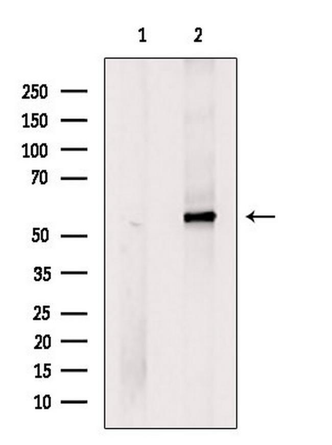 MC5R Antibody in Western Blot (WB)