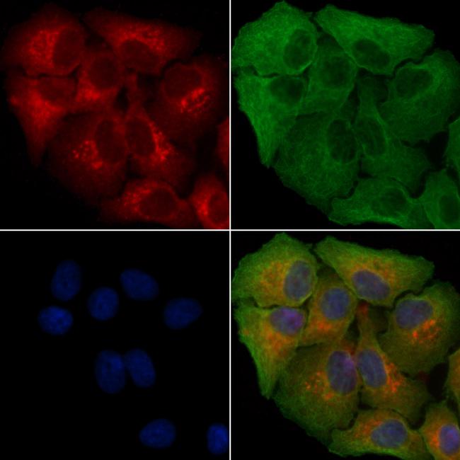 MCHR2 Antibody in Immunocytochemistry (ICC/IF)