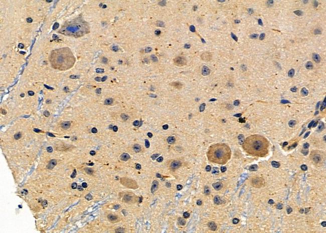 MC1R Antibody in Immunohistochemistry (Paraffin) (IHC (P))