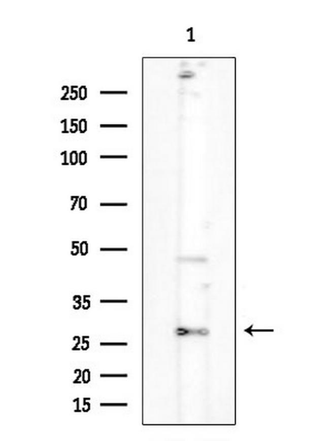 OR2D3 Antibody in Western Blot (WB)