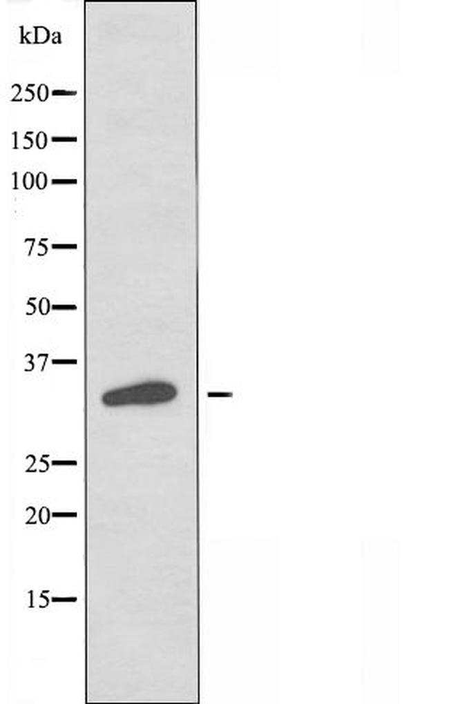 OR2I1P Antibody in Western Blot (WB)