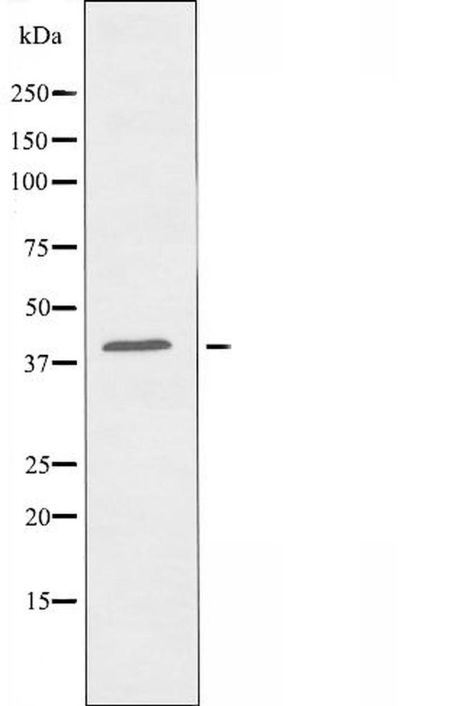 OR2L5 Antibody in Western Blot (WB)