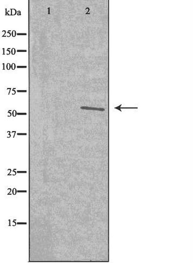 TMEM145 Antibody in Western Blot (WB)