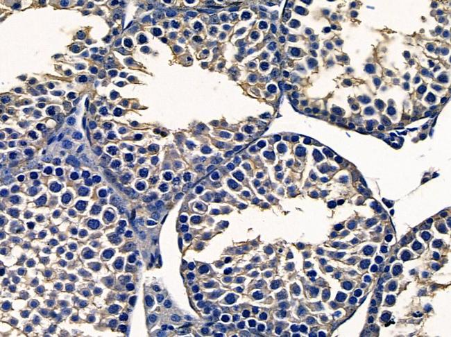 TAS1R3 Antibody in Immunohistochemistry (Paraffin) (IHC (P))