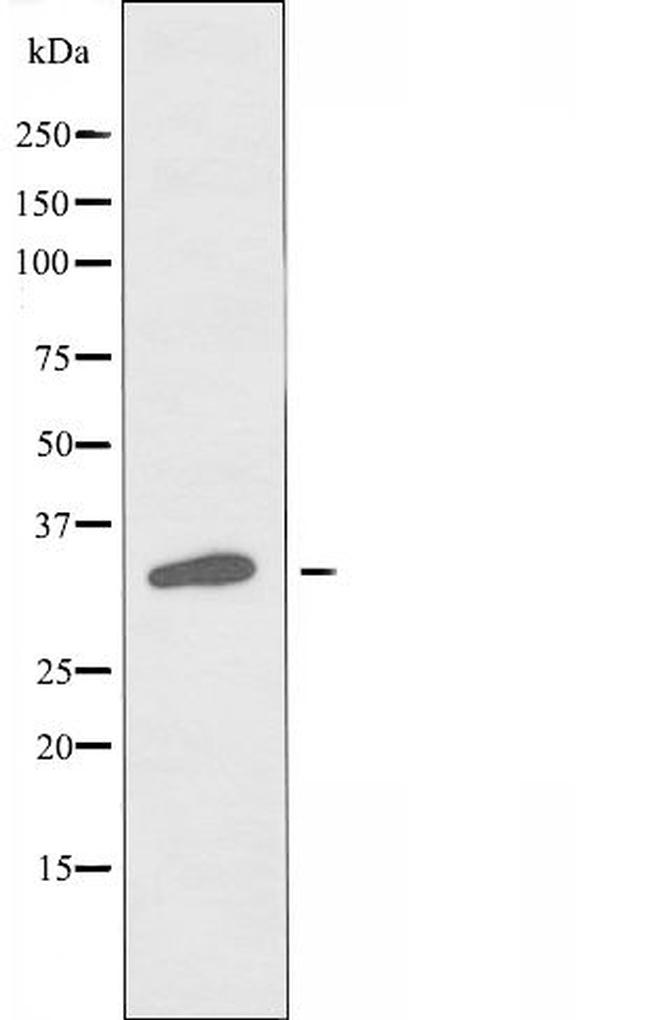 VN1R4 Antibody in Western Blot (WB)