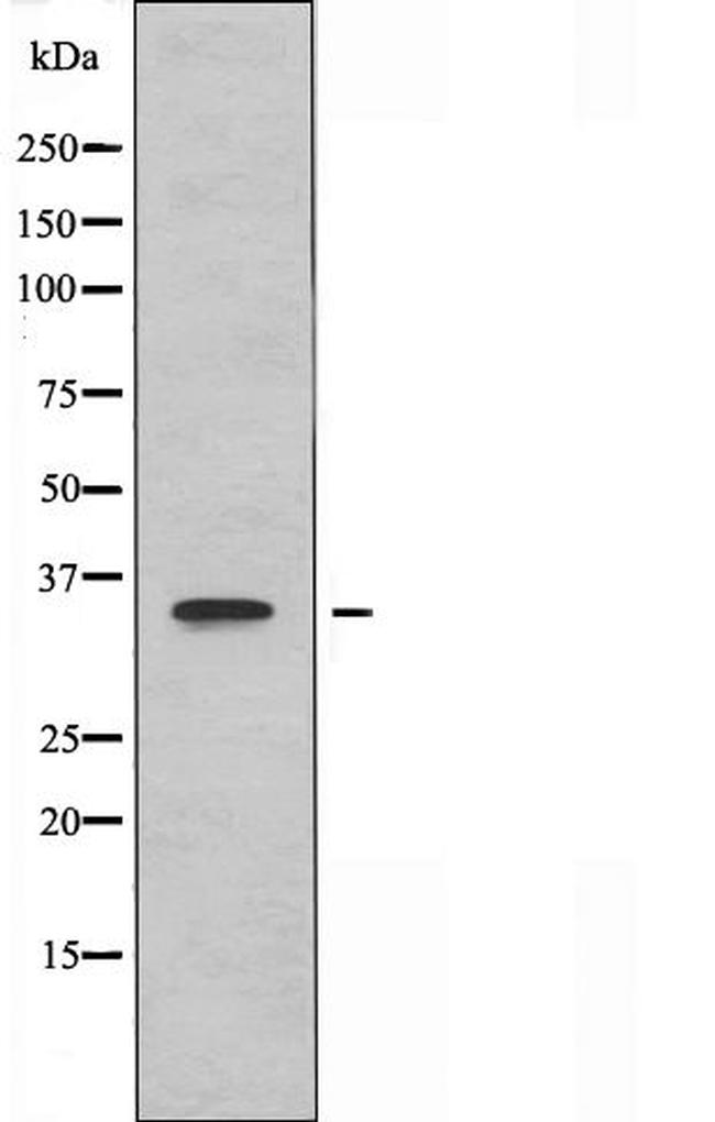 OR10S1 Antibody in Western Blot (WB)