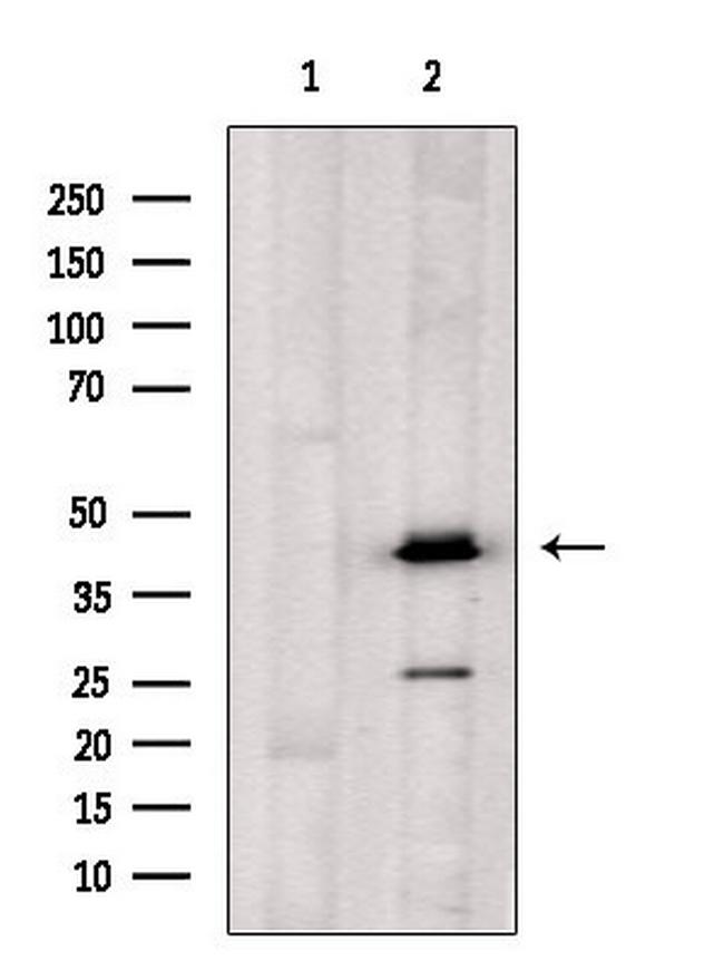 OXER1 Antibody in Western Blot (WB)