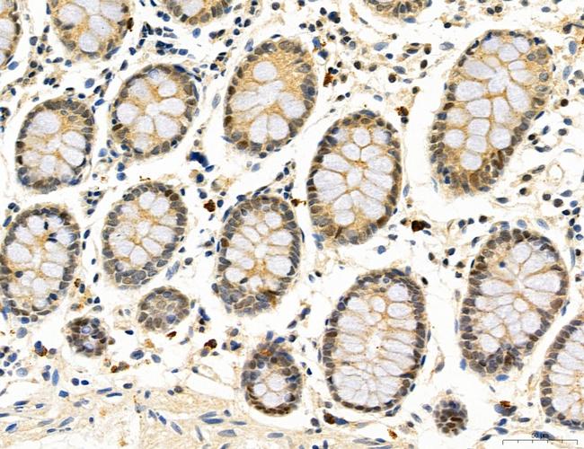 CHOP Antibody in Immunohistochemistry (Paraffin) (IHC (P))