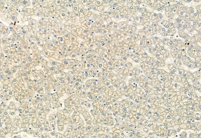 ACVR1C Antibody in Immunohistochemistry (Paraffin) (IHC (P))