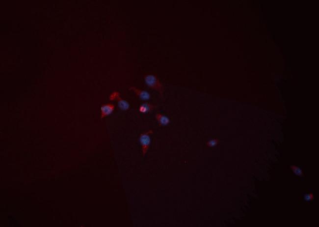 HK2 Antibody in Immunocytochemistry (ICC/IF)