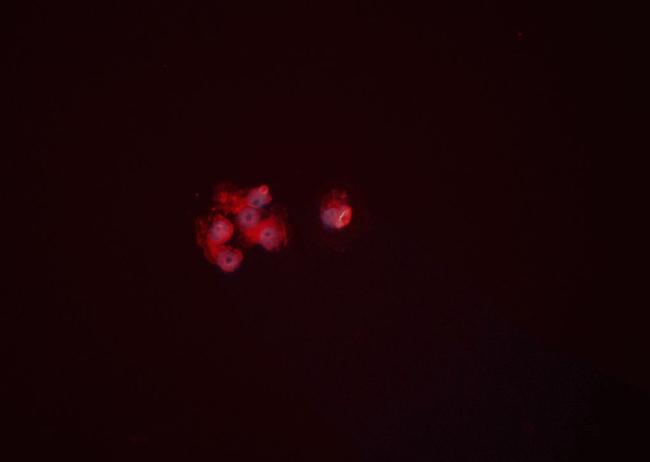 ENO1 Antibody in Immunocytochemistry (ICC/IF)