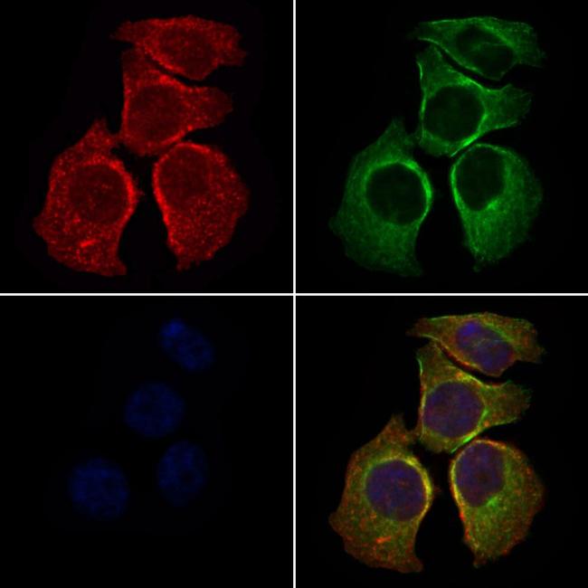 SLC27A2 Antibody in Immunocytochemistry (ICC/IF)