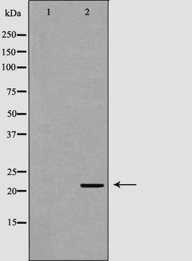 NTF4 Antibody in Western Blot (WB)