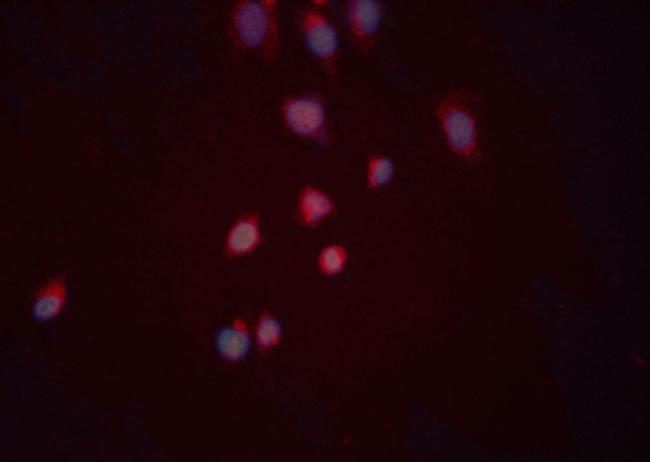 CYR61 Antibody in Immunocytochemistry (ICC/IF)